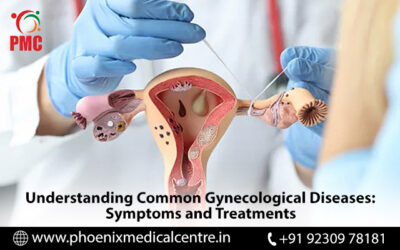 Understanding Common Gynecological Diseases: Symptoms and Treatments