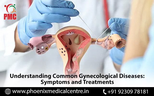 gynaecology diseases