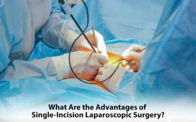 What Are the Advantages of Single-Incision Laparoscopic Surgery?