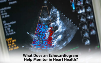 What Does an Echocardiogram Help Monitor in Heart Health?
