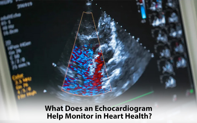 echo test cardiology