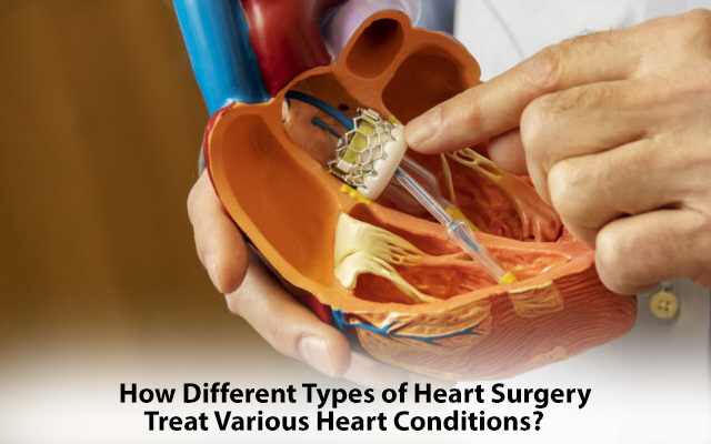 cardiology surgery types