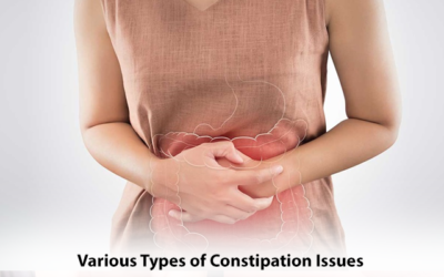 Various Types of Constipation Issues