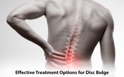 Effective Treatment Options for Disc Bulge