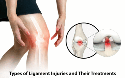Types of Ligament Injuries and Their Treatments