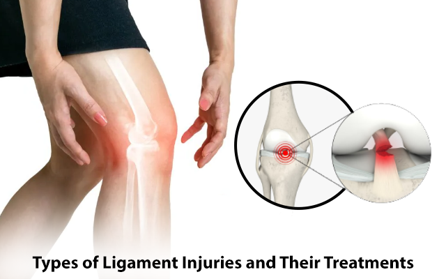 Types of Ligament Injuries and Their Treatments