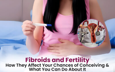 Fibroids and Fertility: How They Affect Your Chances of Conceiving & What You Can Do About It