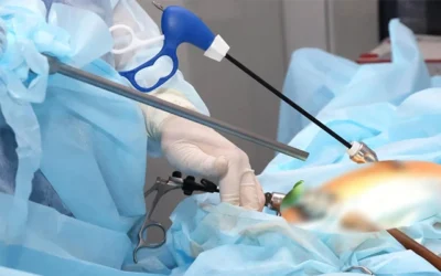 Open Surgery vs Laparoscopy: What’s Safer for Patients?