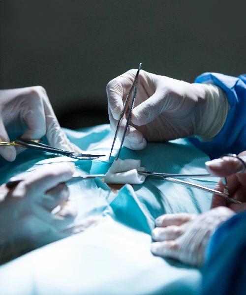 General & Laparoscopic Surgery