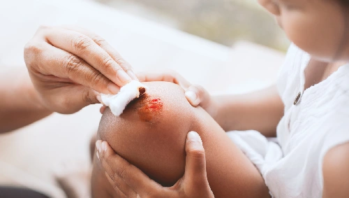 Abscess & Wound Care Surgery