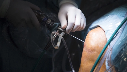 Advanced Surgical Care