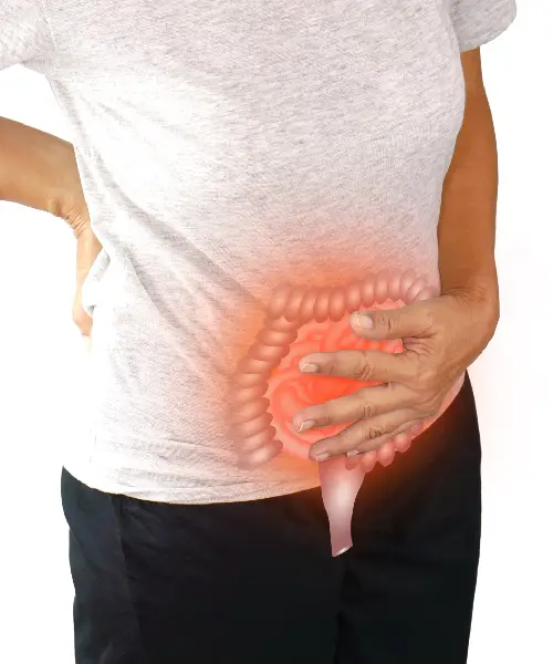 Laparoscopic Appendectomy Laparoscopic Appendectomy