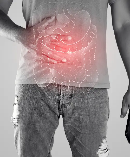 Laparoscopic Appendectomy Laparoscopic Appendectomy