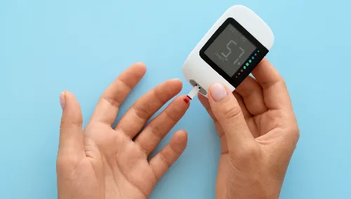 Blood Sugar Monitoring