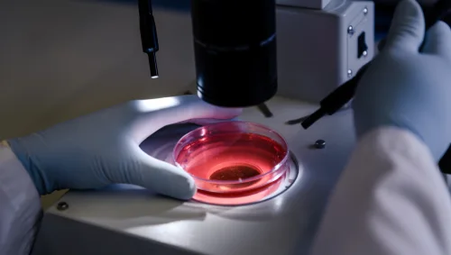 Cancer Diagnosis & Biopsy Support