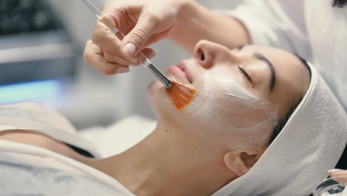 Chemical Peels