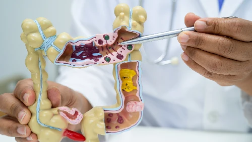 Colorectal Surgery