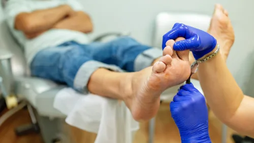 Diabetic Foot Care