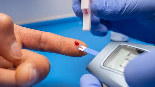 Diabetic Kidney Disease Management