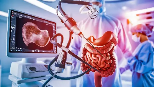 Endoscopy & Colonoscopy Support