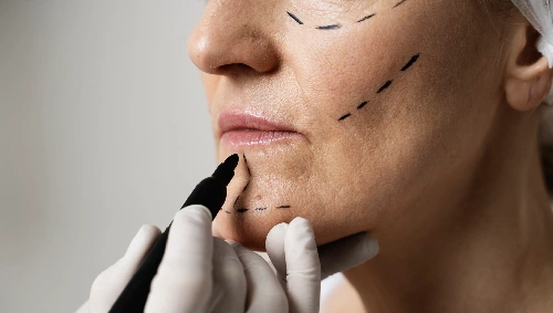Facial Plastic Surgery