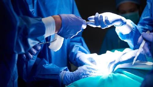 Fissure Surgery