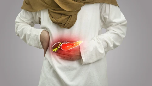 Gallbladder Stone Surgery