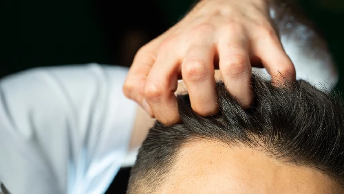 Hair Fall & Scalp Treatment