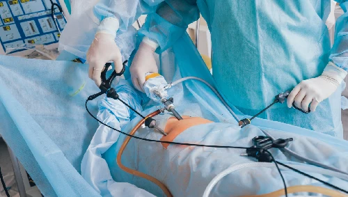Laparoscopic Abdominal Surgery
