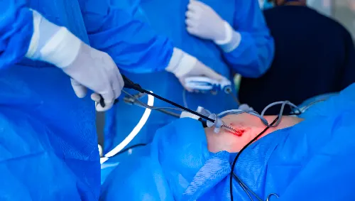 Laparoscopic Appendectomy Laparoscopic Appendectomy