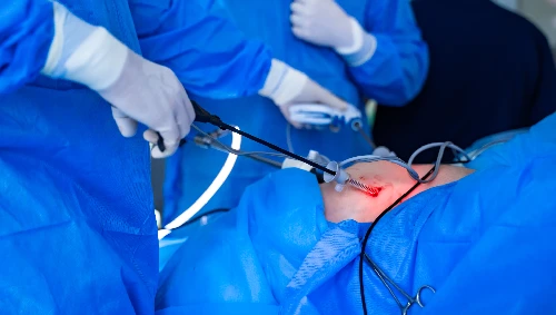 Laparoscopic Cholecystectomy