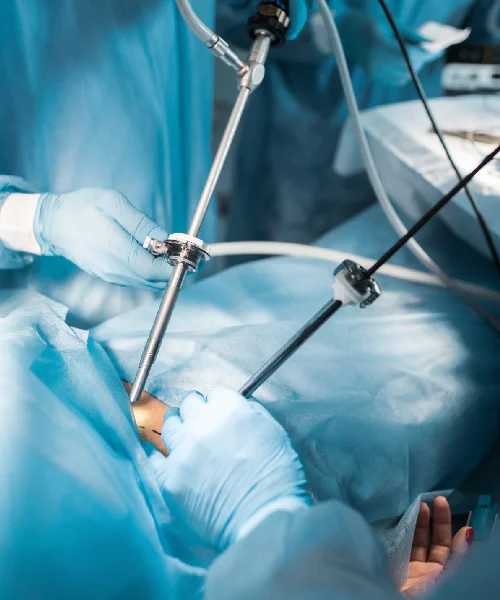 Laparoscopic Gallbladder