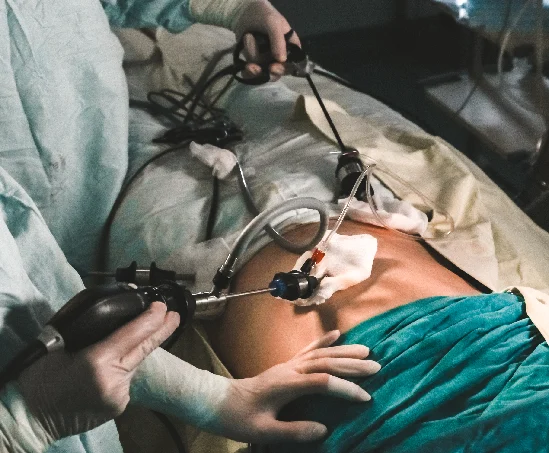 Laparoscopic Gallbladder