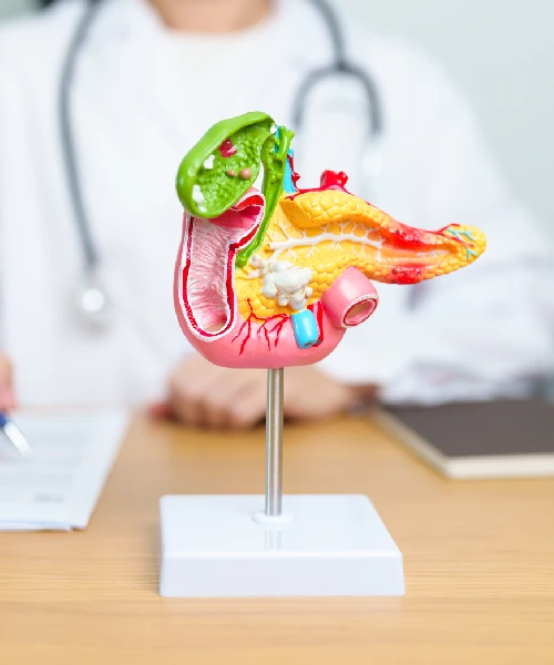 Laparoscopic Gallbladder