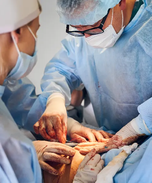 Laparoscopic Hernia Laparoscopic Hernia