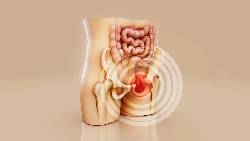 Laparoscopic Inguinal Hernia Repair Laparoscopic Inguinal Hernia Repair