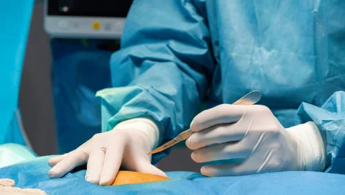 Laparoscopic Umbilical Hernia Repair Laparoscopic Umbilical Hernia Repair