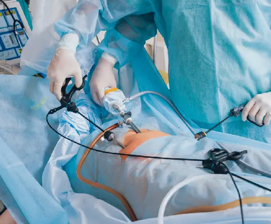 Laparoscopic Hysterectomy Laparoscopic Hysterectomy