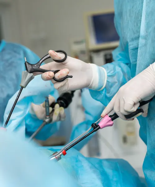 Laparoscopic Hysterectomy Laparoscopic Hysterectomy
