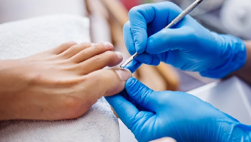 Nail & Fungal Infection Treatment