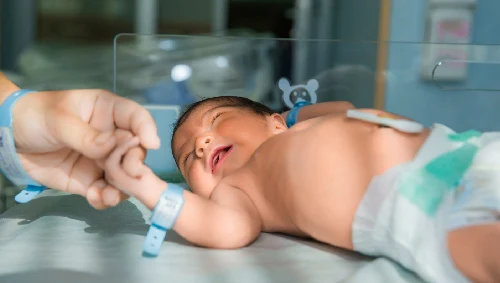 Neonatal Surgery