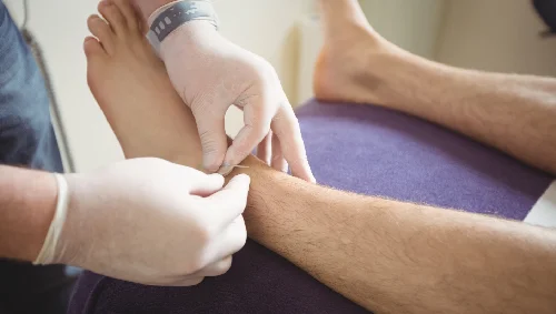 Nerve Compression Surgery