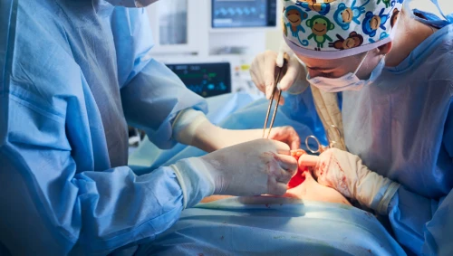 Open Gallbladder Surgery