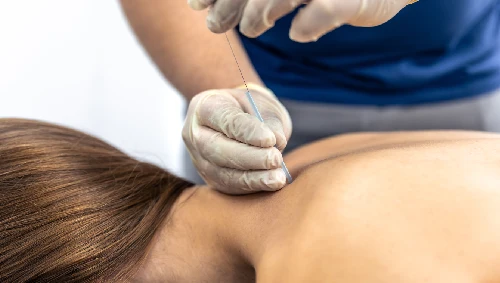Spinal Injections