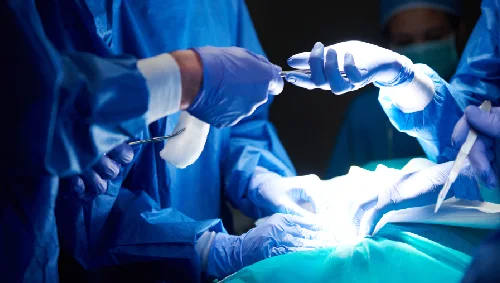 Surgical Tumour Removal