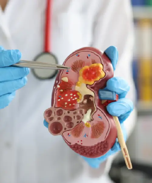 Urology Treatment