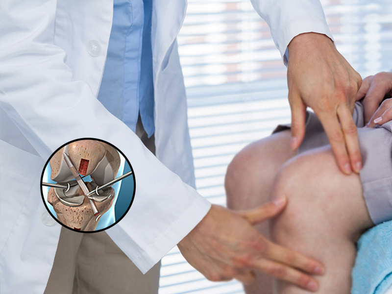 Patient experiencing knee pain followed by expert knee evaluation and early treatment plan for faster recovery and improved mobility